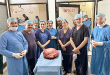 Photo of टीएमयू हॉस्पिटल में जटिल सर्जरी से निकाला 11 किलो का ट्यूमर